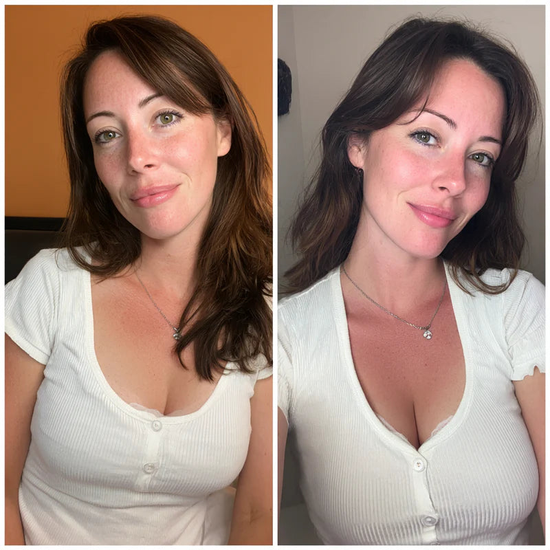 Patchs d'Augmentation Mammaire Chest'Up